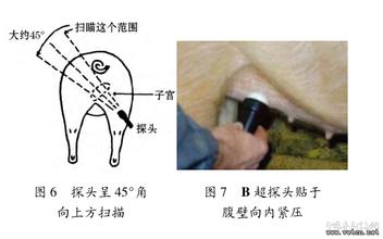 猪B超妊娠诊断技术[农广天地]