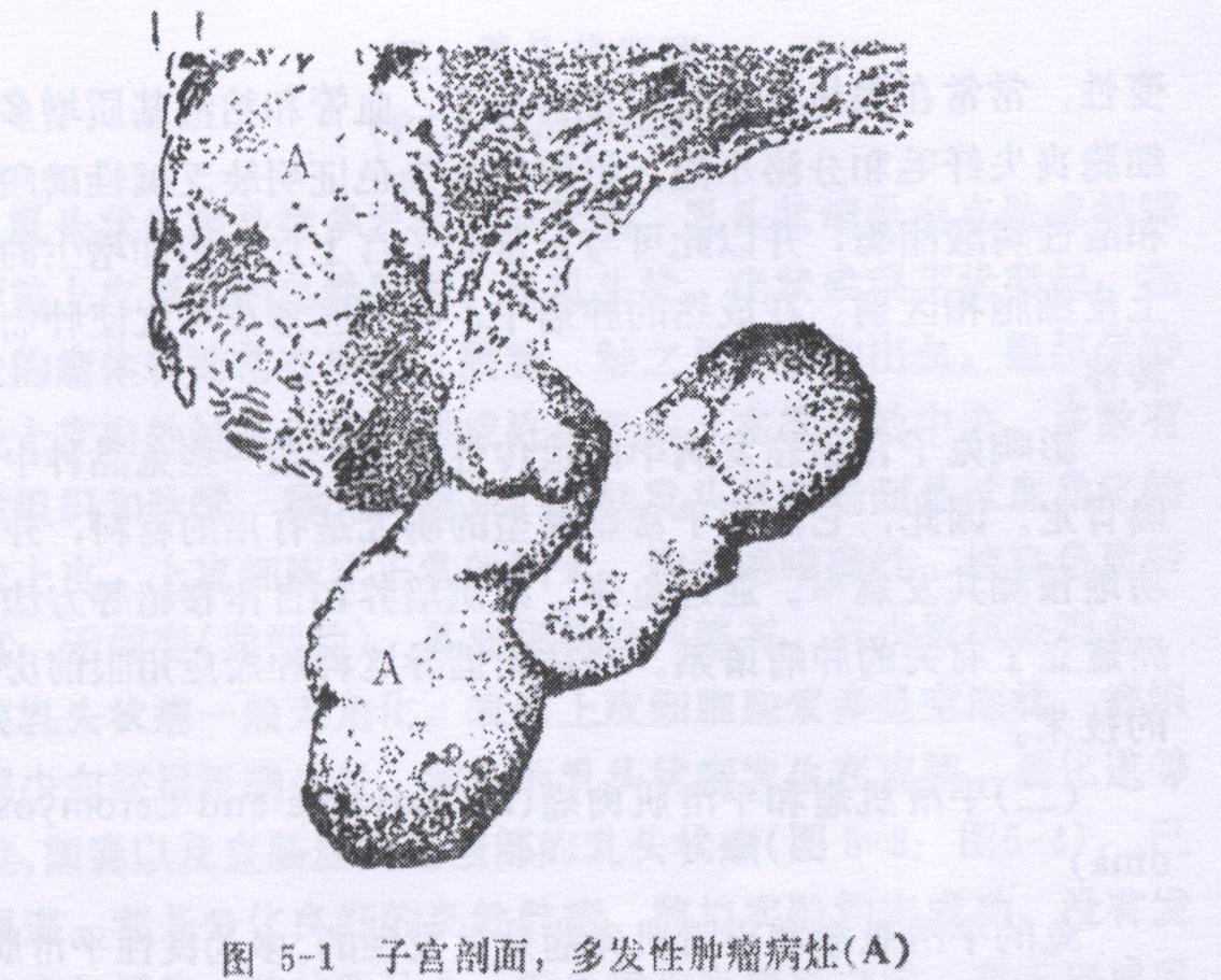 兔子宫腺癌病的症状、诊断和防冶方法