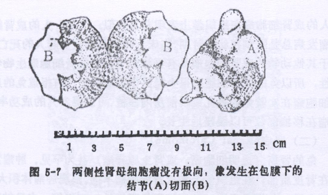 兔成肾细胞癌病的症状、诊断和防冶方法