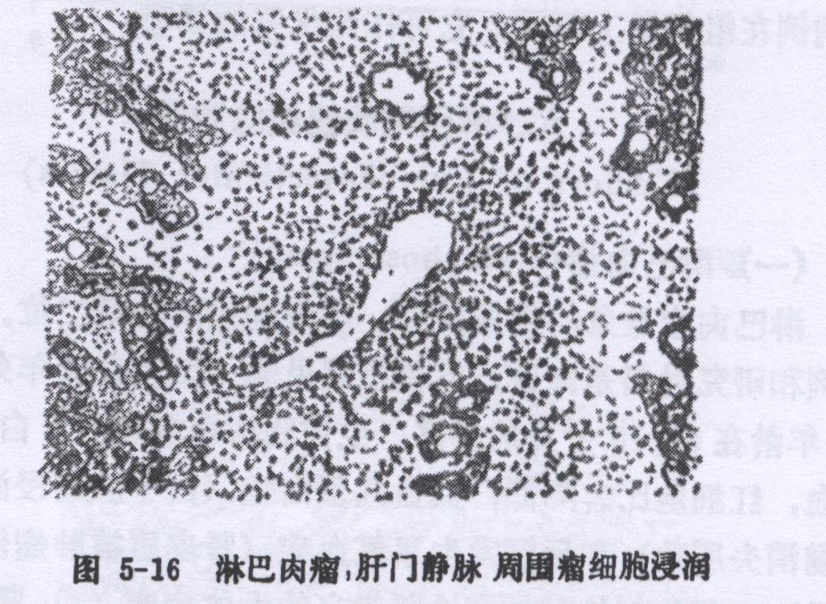 兔淋巴肉瘤病的症状、诊断和防冶方法